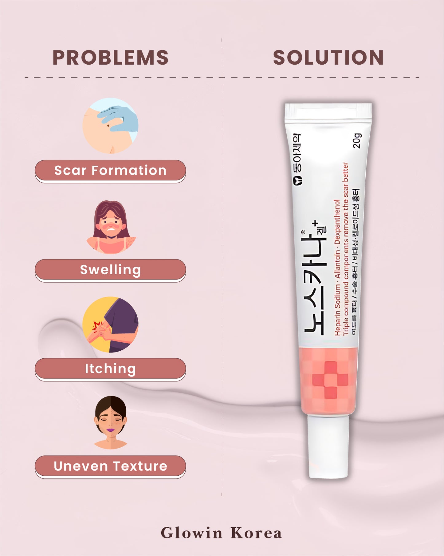 Korean Pharmaceutical Products: Noscarna Acne Treatment Cream