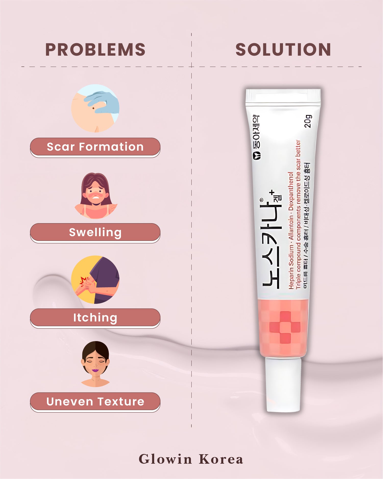 Korean Pharmaceutical Products: Noscarna Acne Treatment Cream