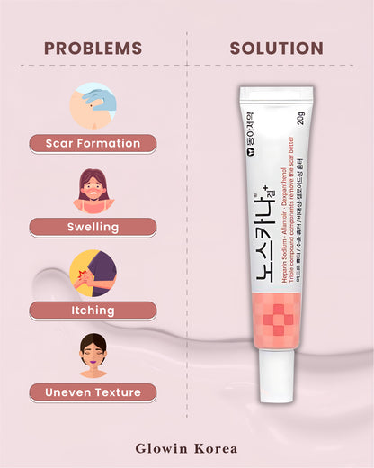 Korean Pharmaceutical Products: Noscarna Acne Treatment Cream