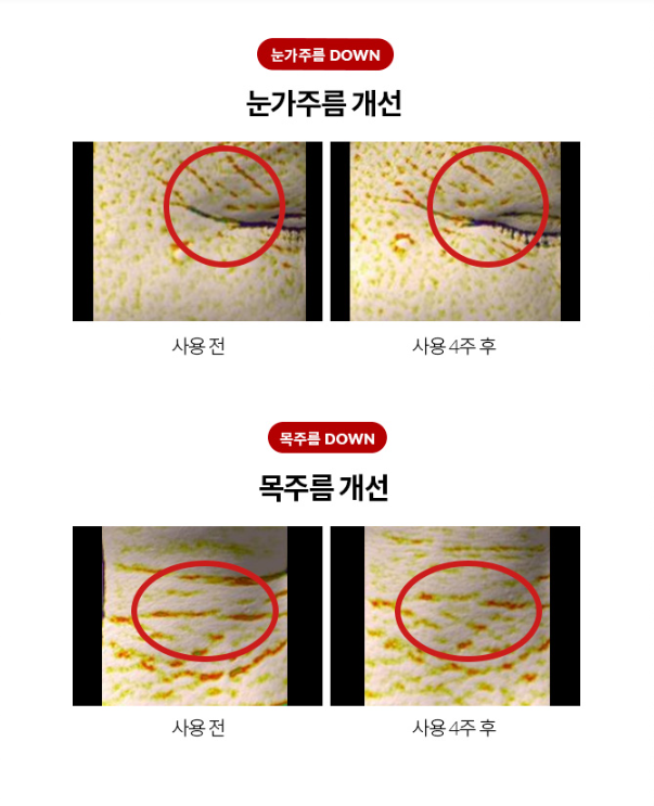 Korean Eye and Neck Retinal | Dr.Different VITALIFT-A Eye & Neck review
