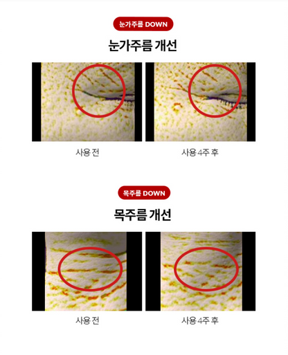 Korean Eye and Neck Retinal | Dr.Different VITALIFT-A Eye & Neck review