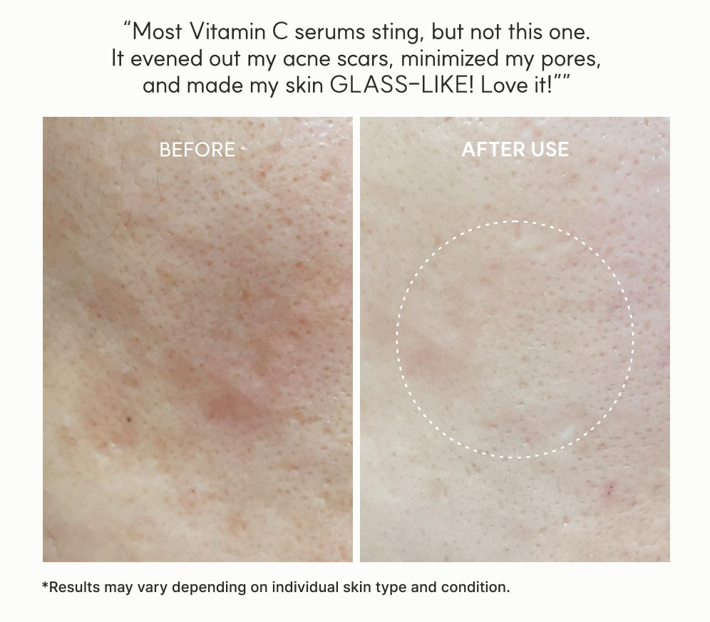 Korean Vitamin C Booster for Radiant & Bright Skin